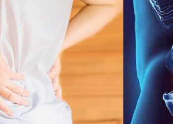 Kebiasaan Sehari-hari yang Membuat Tulang Cepat Rapuh